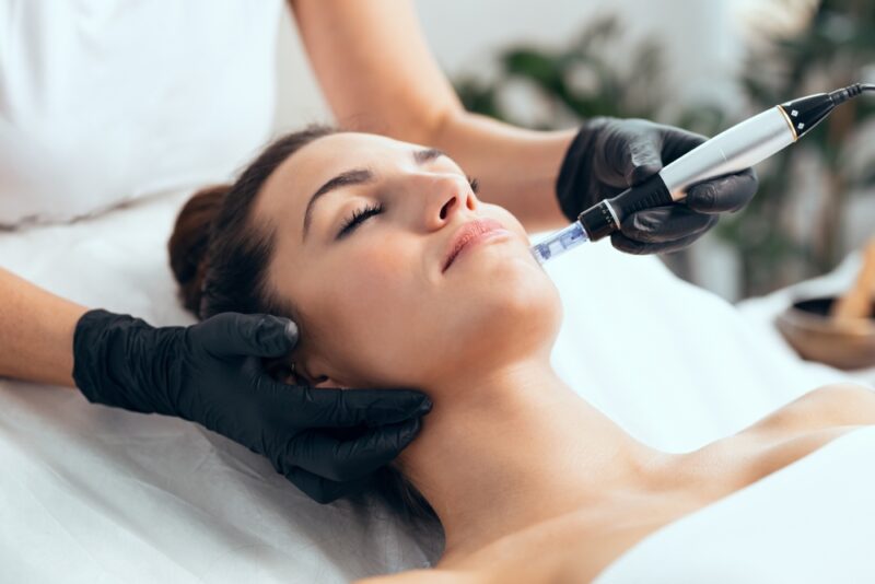 woman receiving a microneedling treatment